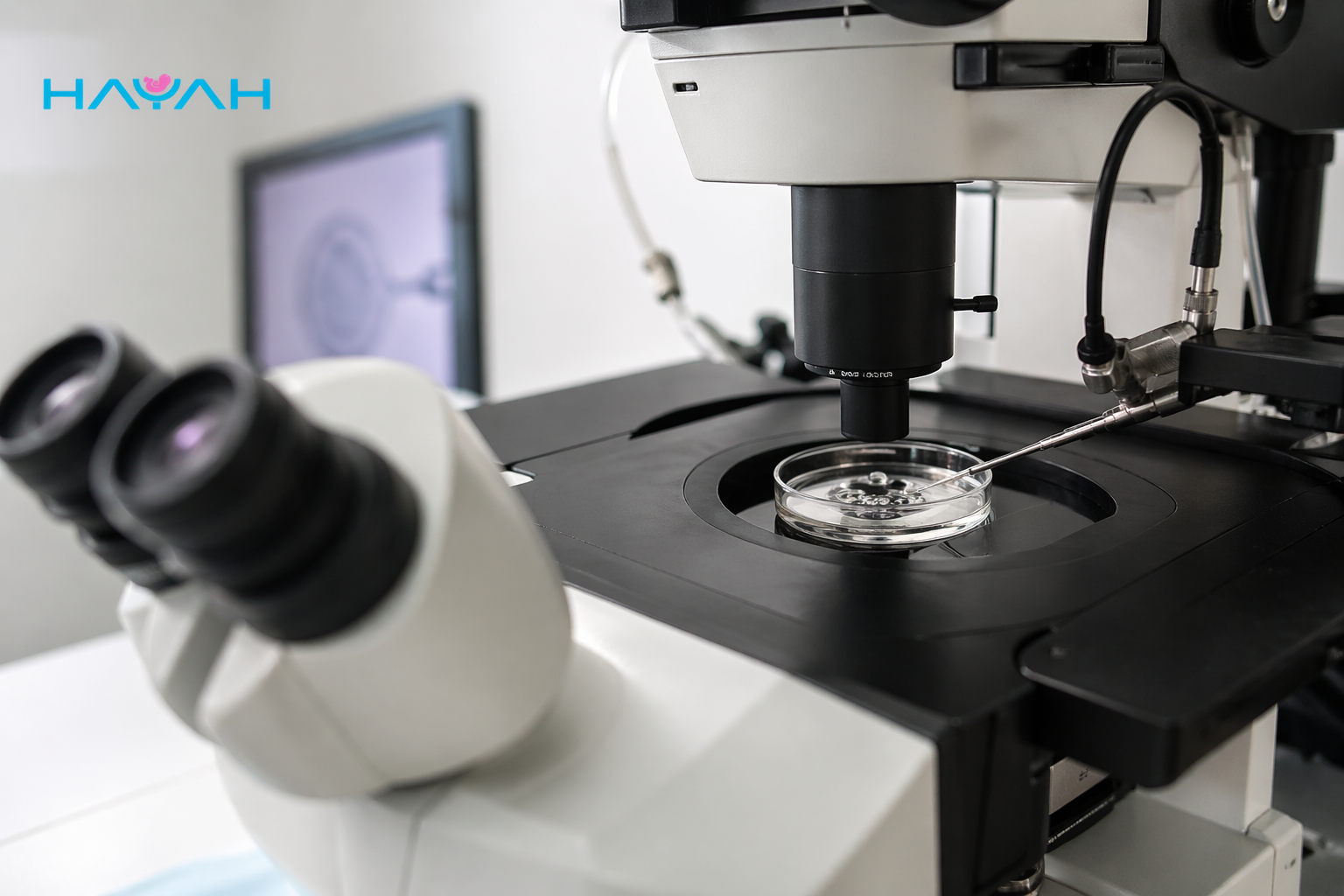 Modern Fertility Techniques: The Difference Between IVF and ICSI